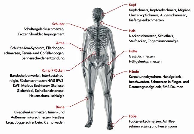 Schmerztherapie Nordheide - Schmerzbehandlung